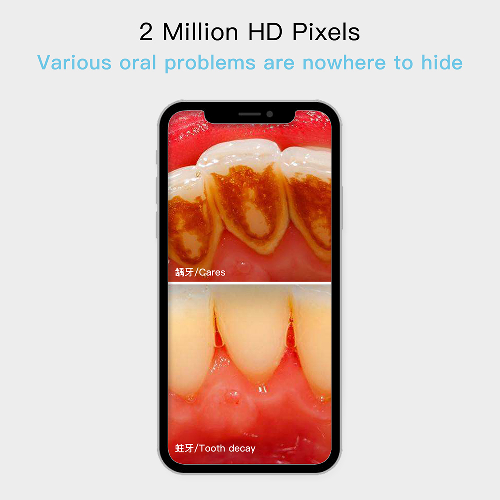 kamera gigi full hd oral dental cam